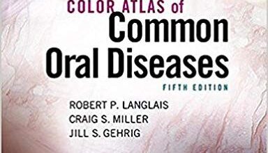 free-pdf-download-Color Atlas of Common Oral Diseases