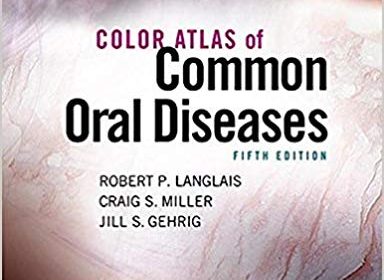 free-pdf-download-Color Atlas of Common Oral Diseases