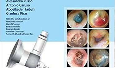 free-pdf-download-Color Atlas of Endo-Otoscopy: Examination-Diagnosis-Treatment 1st Edition