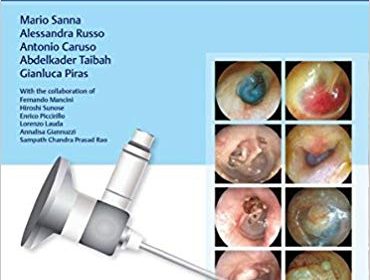 free-pdf-download-Color Atlas of Endo-Otoscopy: Examination-Diagnosis-Treatment 1st Edition