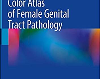 free-pdf-download-Color Atlas of Female Genital Tract Pathology 1st ed. 2019 Edition