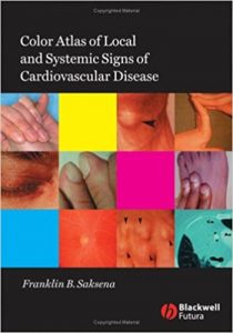 free-pdf-download-Color Atlas of Local and Systemic Signs of Cardiovascular Disease 1st Edition