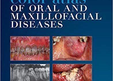 free-pdf-download-Color Atlas of Oral and Maxillofacial Diseases 1st Edition