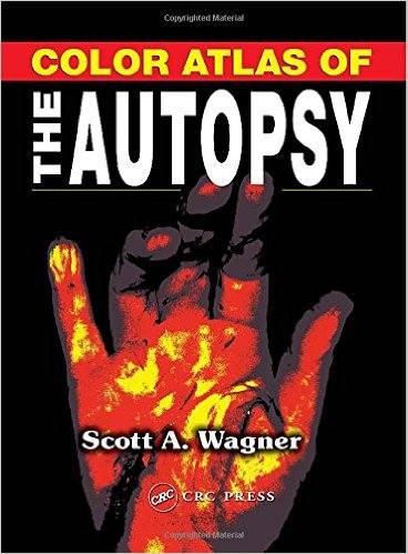 free-pdf-download-Color Atlas of the Autopsy 1st Edition