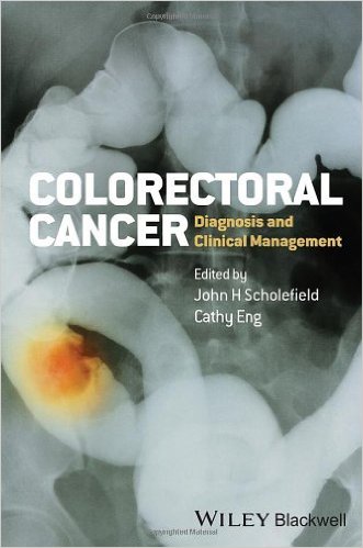 free-pdf-download-Colorectal Cancer: Diagnosis and Clinical Management 1st Edition