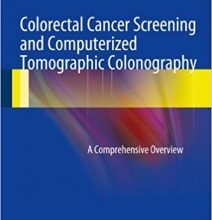 free-pdf-download-Colorectal Cancer Screening and Computerized Tomographic Colonography: A Comprehensive Overview