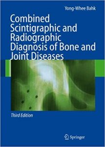 free-pdf-download-Combined Scintigraphic and Radiographic Diagnosis of Bone and Joint Diseases