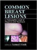 free-pdf-download-Common Breast Lesions: A Photographic Guide to Diagnosis and Treatment 1st Edition