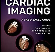 free-pdf-download-Comparative Cardiac Imaging: A Case-based Guide