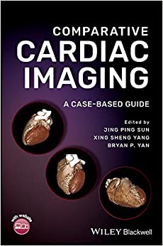 free-pdf-download-Comparative Cardiac Imaging: A Case-based Guide