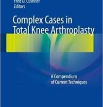 free-pdf-download-Complex Cases in Total Knee Arthroplasty: A Compendium of Current Techniques 1st ed. 2018 Edition