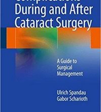 free-pdf-download-Complications During and After Cataract Surgery: A Guide to Surgical Management