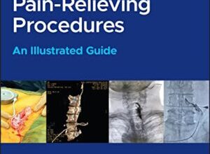 free-pdf-download-Complications of Pain-Relieving Procedures: An Illustrated Guide