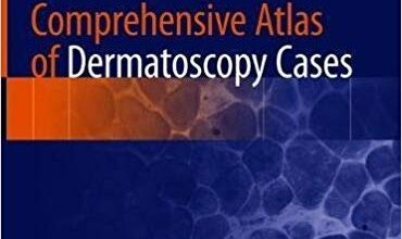 free-pdf-download-Comprehensive Atlas of Dermatoscopy Cases 1st ed