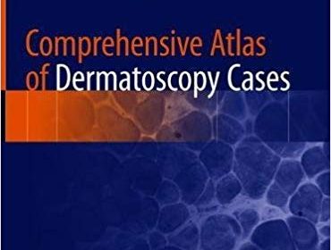 free-pdf-download-Comprehensive Atlas of Dermatoscopy Cases 1st ed