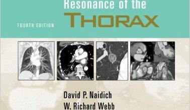 free-pdf-download-Computed Tomography and Magnetic Resonance of the Thorax Fourth Edition