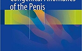 free-pdf-download-Congenital Anomalies of the Penis 1st ed. 2017 Edition