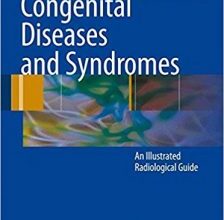 free-pdf-download-Congenital Diseases and Syndromes: An Illustrated Radiological Guide