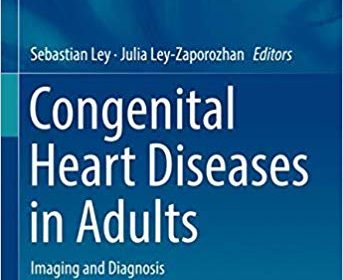 free-pdf-download-Congenital Heart Diseases in Adults: Imaging and Diagnosis (Medical Radiology) 1st ed