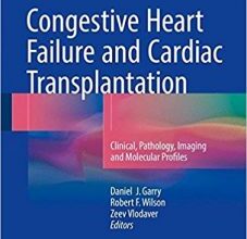 free-pdf-download-Congestive Heart Failure and Cardiac Transplantation: Clinical