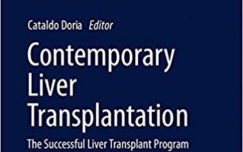 free-pdf-download-Contemporary Liver Transplantation: The Successful Liver Transplant Program (Organ and Tissue Transplantation) 1st ed. 2017 Edition