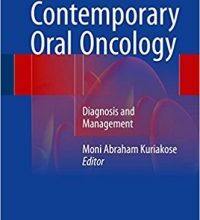 free-pdf-download-Contemporary Oral Oncology: Diagnosis and Management 1st ed. 2017 Edition