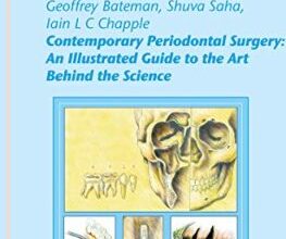 free-pdf-download-Contemporary Periodontal Surgery: An Illustrated Guide to the Art behind the Science