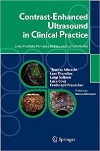 free-pdf-download-Contrast-Enhanced Ultrasound in Clinical Practice: Liver