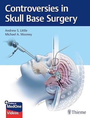 free-pdf-download-Controversies in Skull Base Surgery 1st Edition