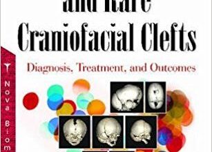 free-pdf-download-Craniosynostosis and Rare Craniofacial Clefts: Diagnosis