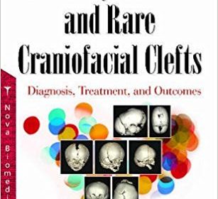 free-pdf-download-Craniosynostosis and Rare Craniofacial Clefts: Diagnosis