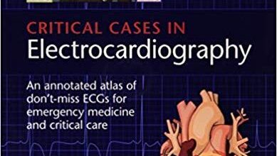 free-pdf-download-Critical Cases in Electrocardiography