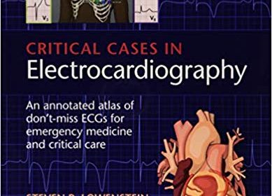 free-pdf-download-Critical Cases in Electrocardiography