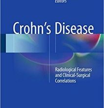 free-pdf-download-Crohn’s Disease: Radiological Features and Clinical-Surgical Correlations 1st ed