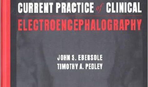 free-pdf-download-Current Practice of Clinical Electroencephalography: 3rd Edition