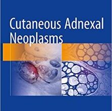 free-pdf-download-Cutaneous Adnexal Neoplasms 1st ed