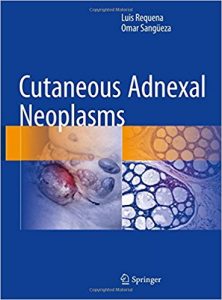 free-pdf-download-Cutaneous Adnexal Neoplasms 1st ed