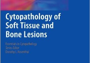 free-pdf-download-Cytopathology of Soft Tissue and Bone Lesions (Essentials in Cytopathology) 2011th Edition