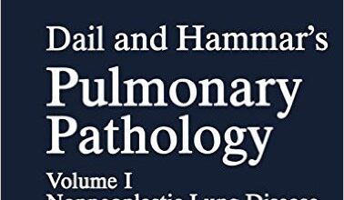 free-pdf-download-Dail and Hammar’s Pulmonary Pathology