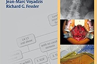 free-pdf-download-Decision Making for Minimally Invasive Spine Surgery 1st Edition