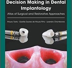 free-pdf-download-Decision Making in Dental Implantology: Atlas of Surgical and Restorative Approaches 1st Edition