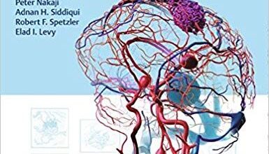 free-pdf-download-Decision Making in Neurovascular Disease 1st Edition