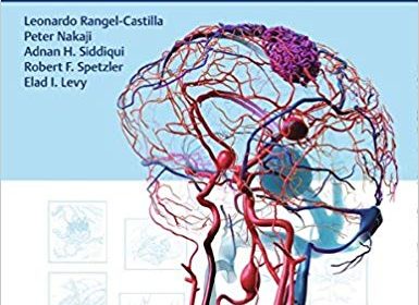 free-pdf-download-Decision Making in Neurovascular Disease 1st Edition