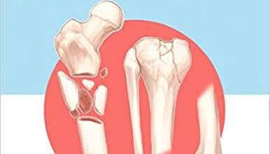 free-pdf-download-Decision Making in Orthopaedic Trauma 1st Edition