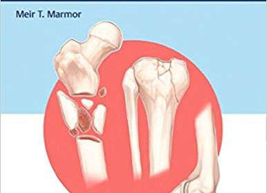 free-pdf-download-Decision Making in Orthopaedic Trauma 1st Edition