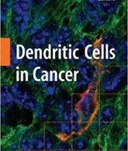 free-pdf-download-Dendritic Cells in Cancer 2009th Edition