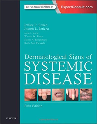 free-pdf-download-Dermatological Signs of Systemic Disease