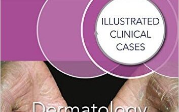 free-pdf-download-Dermatology: Illustrated Clinical Cases 1st Edition