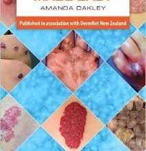 free-pdf-download-Dermatology Made Easy 1st Edition