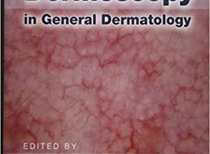 free-pdf-download-Dermoscopy in General Dermatology 1st Edition